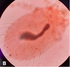 Larva de ácaro trombiculídeo